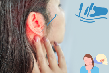 Acupuncture For Tinnitus