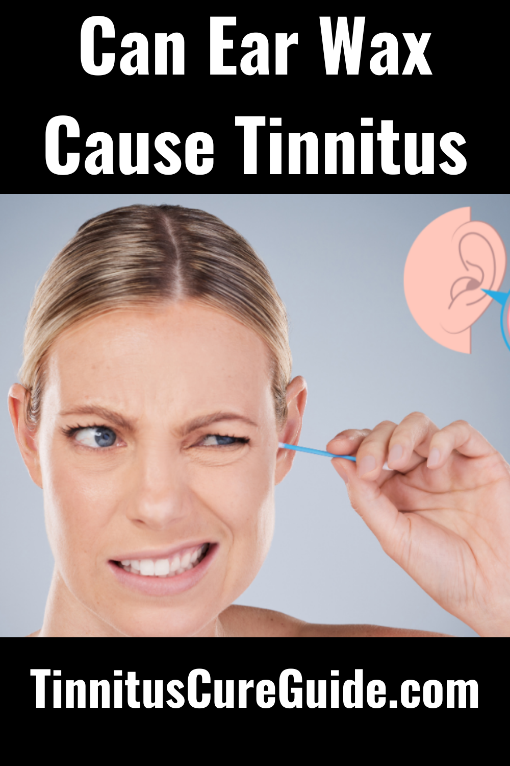 Can Ear Wax Cause Tinnitus Tinnitus Cure Guide