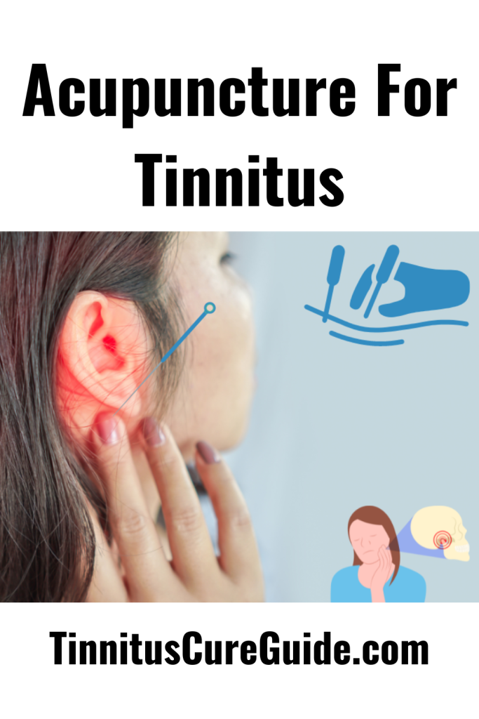 Acupuncture For Tinnitus - Tinnitus Cure Guide