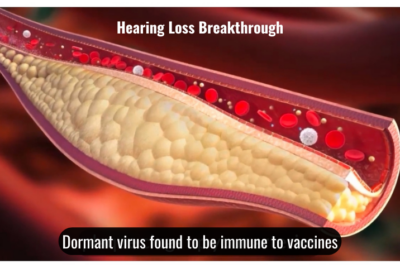 Faulty Brain Wire Causes Ear Ringing and Tinnitus
